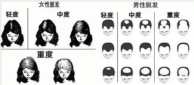 黑奥秘头发理疗中心