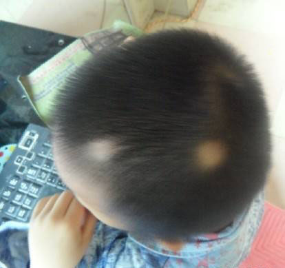 timg (1)